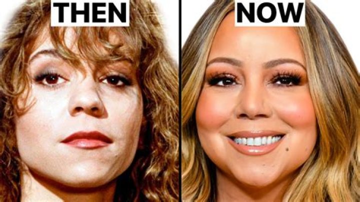 Mariah Carey's Plastic Surgery Journey Explored
