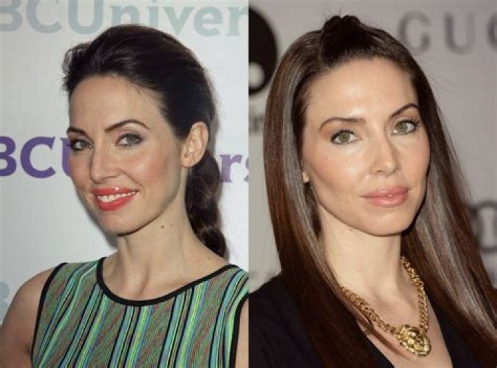 Whitney Cummings Plastic Surgery: Everything You Should Know